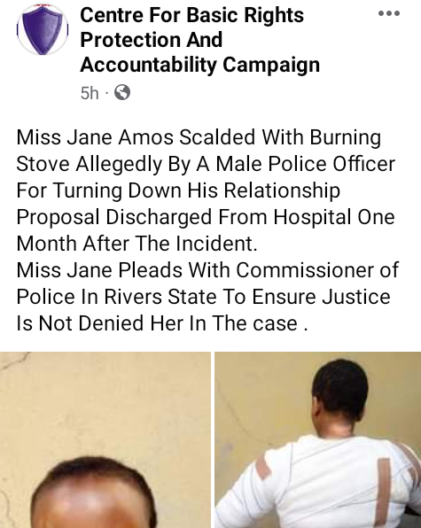 Update: Lady discharged from hospital a month after Rivers police officer allegedly scalded her with burning stove for turning down his relationship proposal 